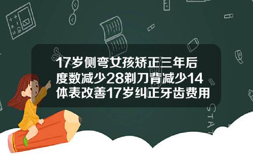 17岁侧弯女孩矫正三年后度数减少28剃刀背减少14体表改善17岁纠正牙齿费用